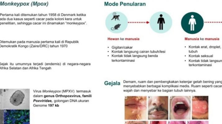 Cegah Penularan Mpox, Kemenkes Minta Masyarakat Jaga Higienitas