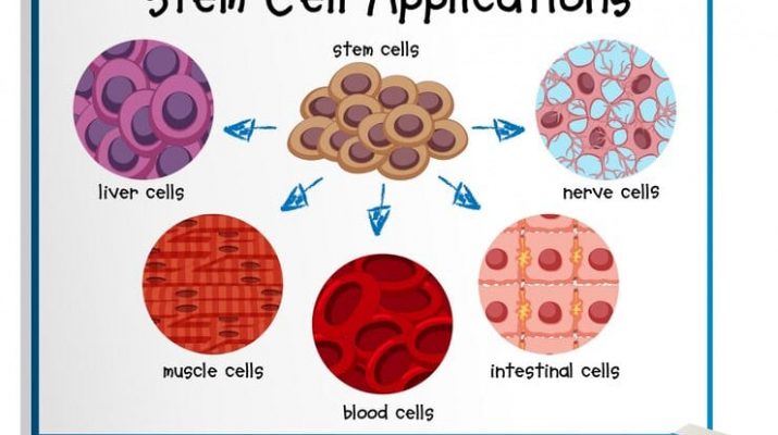 Waspadai Terapi Stem Cell Palsu