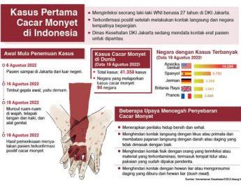 Kasus Pertama Cacar Monyet di Indonesia