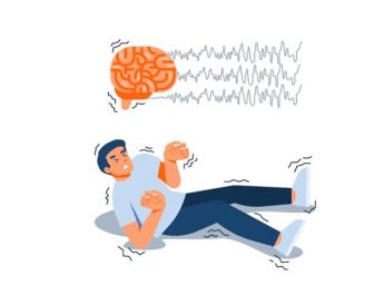 Vagus Nerve Stimulation, Solusi Modern Atasi Epilepsi