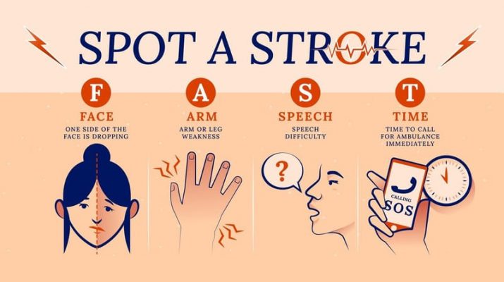 Penanganan Stroke yang Cepat dan Tepat, Kunci Kesembuhan