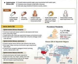 Kenali Penyakit Genetik Langka Epidermolisis Bulosa