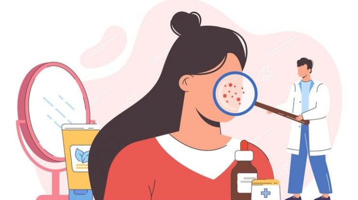 Melasma, Bintik Cokelat di Wajah, Bahaya atau Tidak?