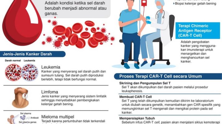 Teknologi Terbaru Car-T Cell Atasi Kanker Darah, Tingkatkan Harapan Hidup