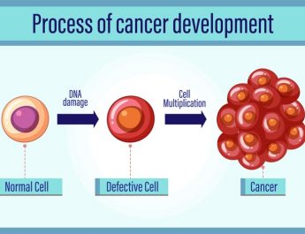 Multiple Myeloma, Risiko Meningkat dengan Pertambahan Usia