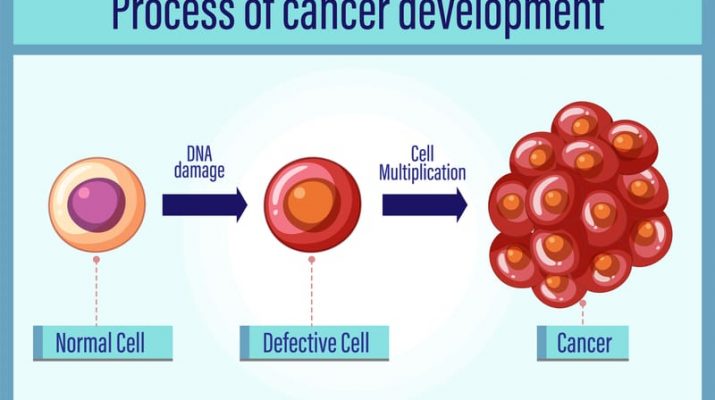 Multiple Myeloma, Risiko Meningkat dengan Pertambahan Usia